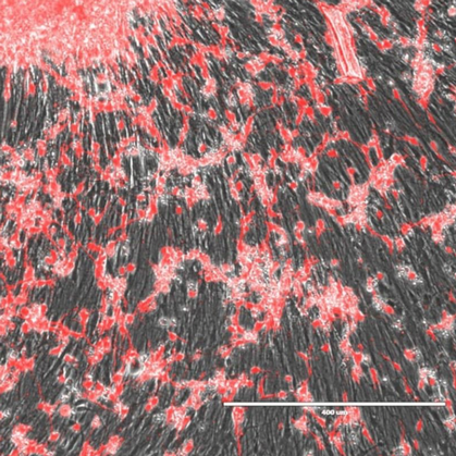 Microscopic image of myelin and oligodendrocytes. Appears as red dots scattered across black lines.